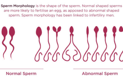 Understanding-your-Semen-Analysis-Report