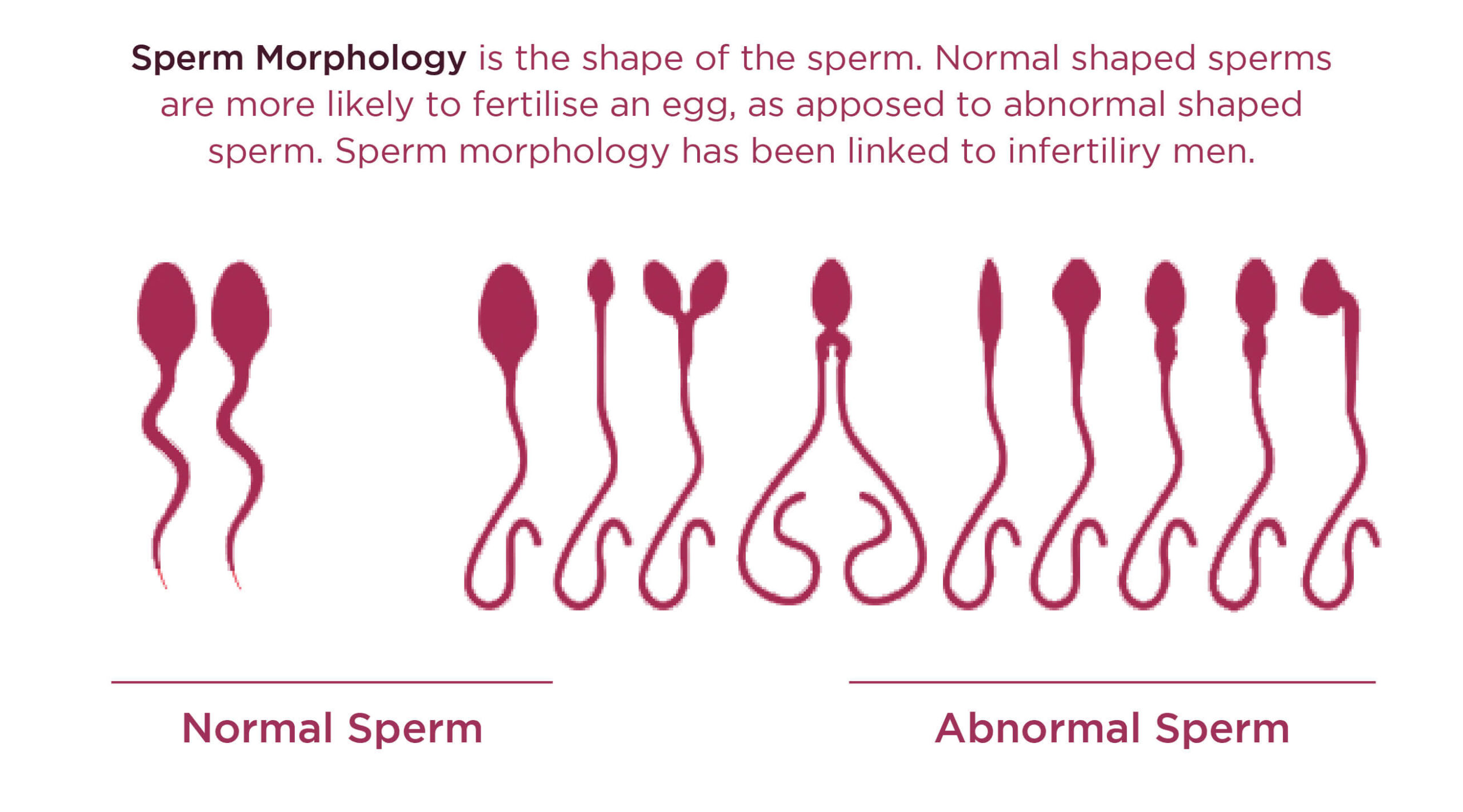 how-to-read-a-sperm-analysis-report-best-ivf-center-in-bangladesh